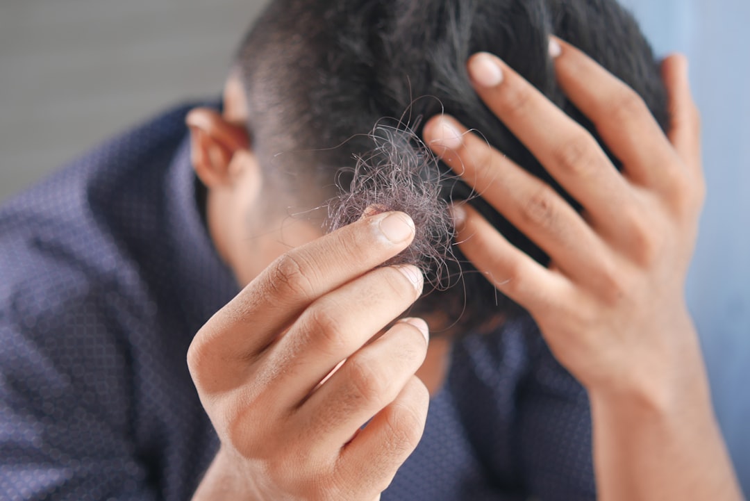 The Plot Twist: EMF as a Hair Loss Treatment